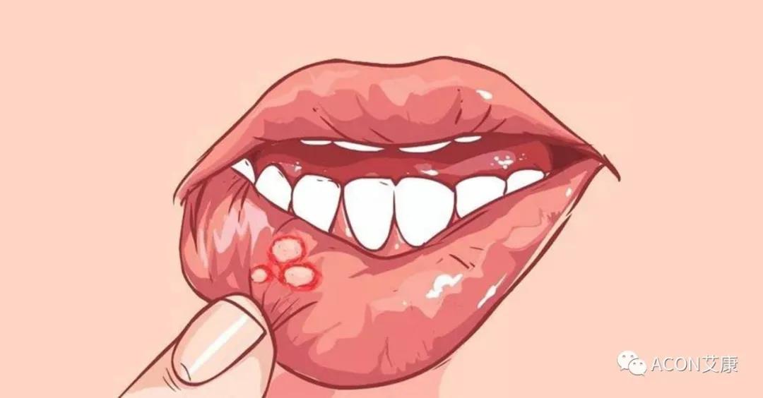 哪些小病容易讓人忽視，最后造成越拖越嚴(yán)重呢？