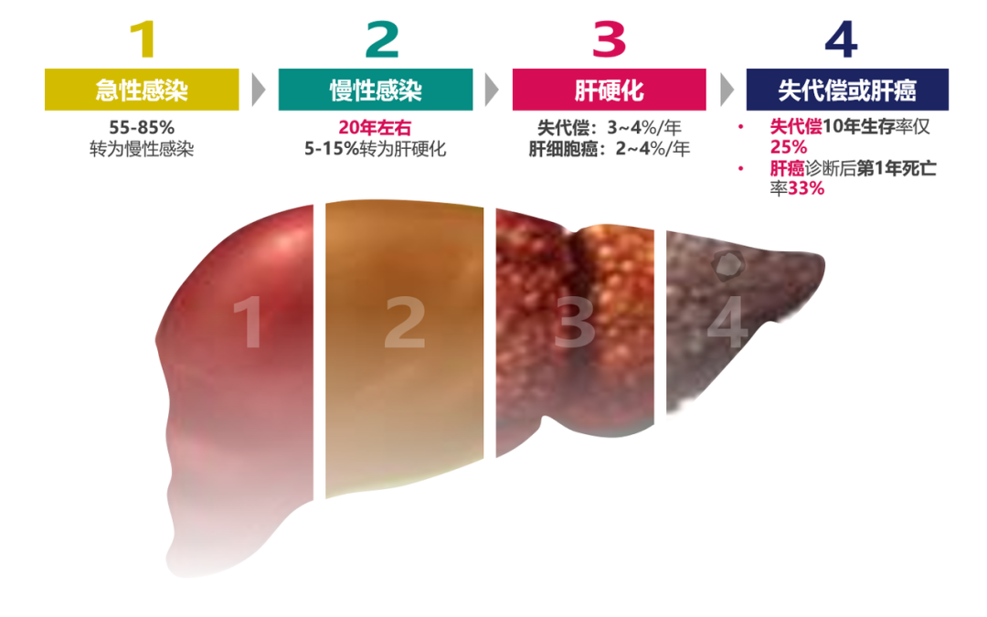 悄悄變成肝硬化、肝癌，很多人感染了卻不知道