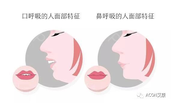 過敏性鼻炎會讓孩子變傻？！家長該如何應(yīng)對